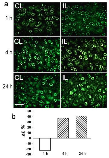 Epigenetic Alterations Induced by Photothrombotic Stroke in the Rat ...