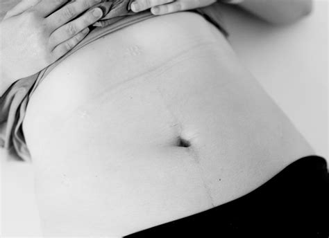 Pelvic Floor Therapy for Endometriosis - The Vagina Whisperer