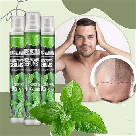 Buy HairReBirth Herbal Spray,Herbal Hair Growth Maximizer Spray ...