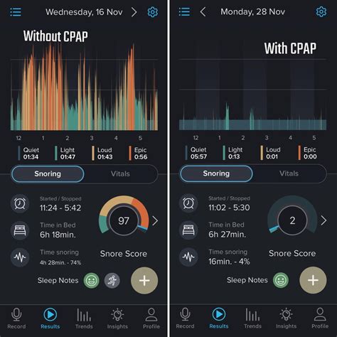 Image result for CPAP for Snoring