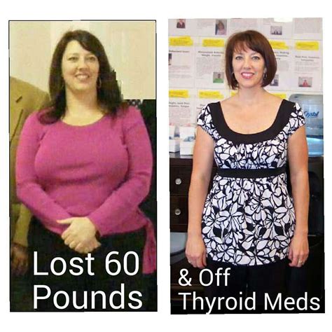 Weight Loss After Hashimoto's Diagnosis at Richard Colon blog