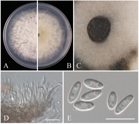 Characterization of Fungal Pathogens Causing Blueberry Fruit Rot ...