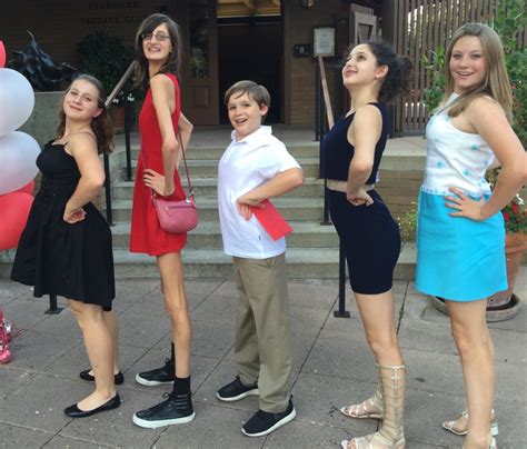 Marfan Syndrome Girl