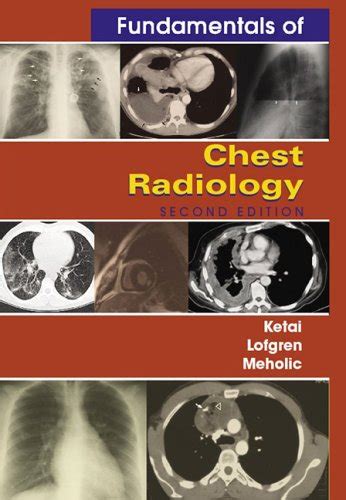 Buy Fundamentals of Chest Radiology (Fundamentals of Radiology) Book ...