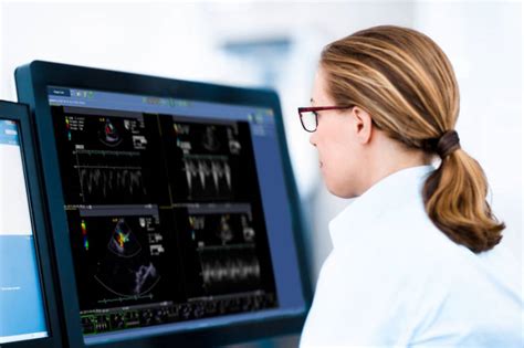 Image result for Sectra Pacs Tutorial