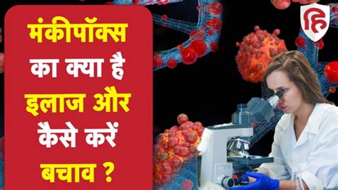 What is the treatment of monkeypox and how to prevent it मंकीपॉक्स का ...