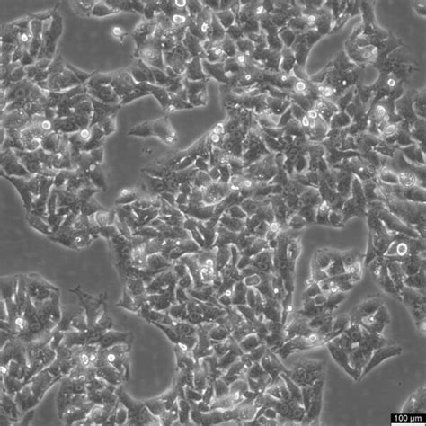 Image result for HepG2 Intraperitoneal Injection