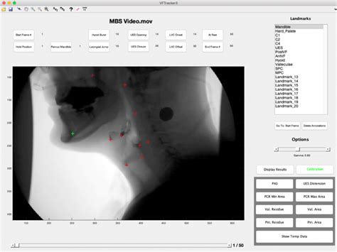 How to Use MATLAB Point Tracker 的图像结果
