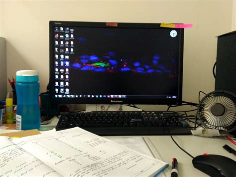 Image result for LED-backlit LCD