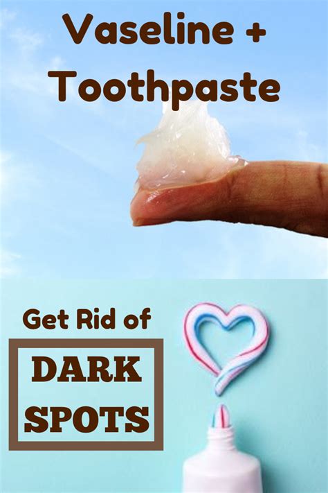Toothpaste On Dark Spots 的图像结果