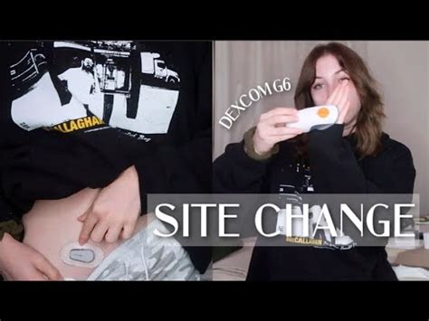 Image result for Dexcom G6 Tutorial YouTube