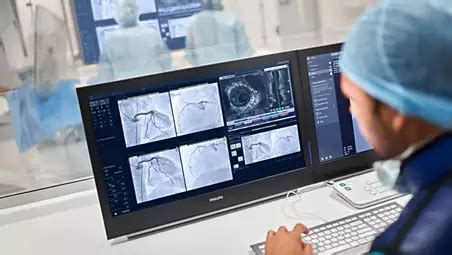 Philips - ClarityIQ imaging technology
