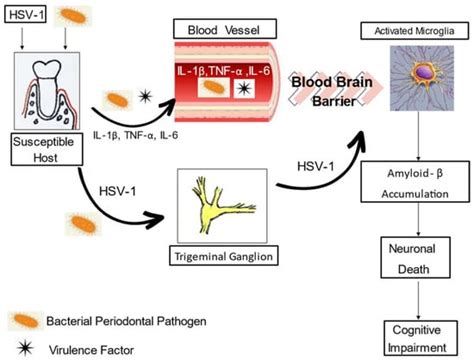 Periodontitis and Alzheimer’s Disease: Is There a Connection?