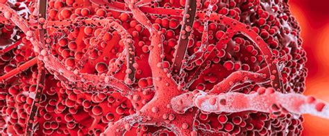 Boston Scientific Recalls Carotid Stents Over Safety Risks