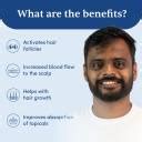 Man Matters Derma Roller 1mm with 540 Titanium needles | Promotes ...