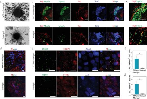 Image result for Modiolus Cochlea