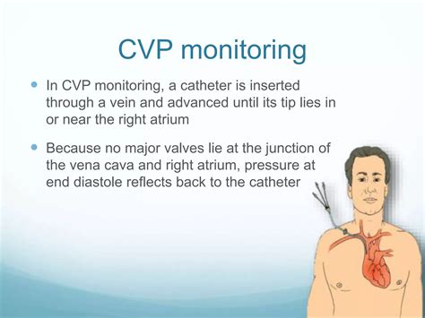 CVP Pulmonary artery wedge pressure monitoring: Physiology | PPSX