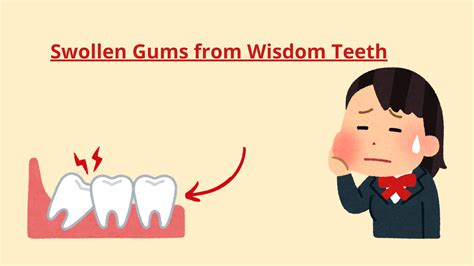 Swollen Gums from Wisdom Teeth: What’s Normal and When to Worry