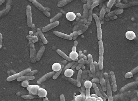 Oilzapper - Innovative Solution for Oil Spill Remediation