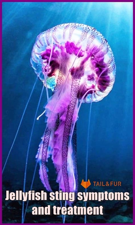 Jellyfish sting symptoms and treatment