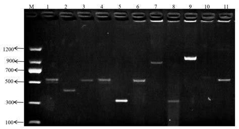 Isolation and Characterization of Vancomycin-Resistant Enterococcus ...