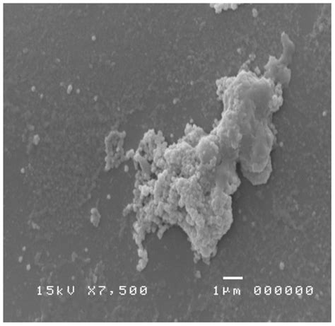 Identification and Characterization of Nasal Polyposis and Mycoplasma ...