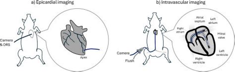 Image result for Left Thoracotomy