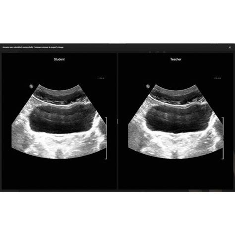 e Sono Ultrasound Simulation Software | Ultrasound Software Simulator e ...