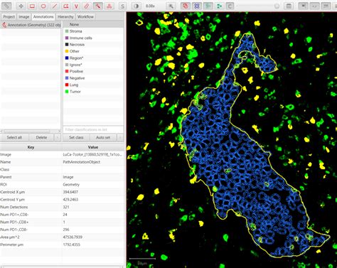 Image result for QuPath Image Analysis
