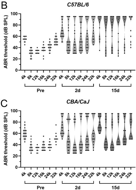 Effects of Combined Gentamicin and Furosemide Treatment on Cochlear ...