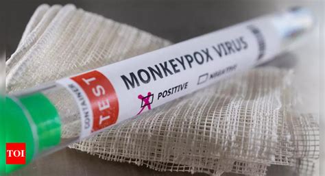 Monkeypox: First monkeypox death in Nigeria in 2022; 21 cases confirmed ...