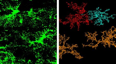 Image result for Astrocyte