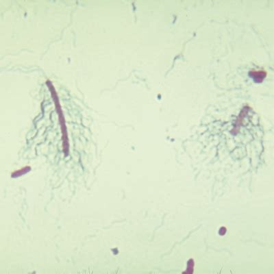 Image result for Bacteria Microscope Slides