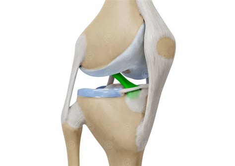 Illustrations knee and meniscus - MedicalGraphics