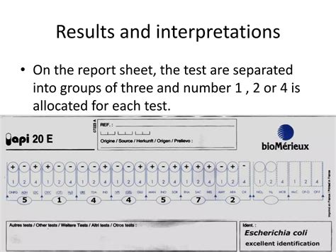 Image result for API E20 Test