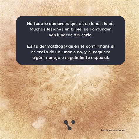 Nevus | Especialistas en lunares | Hoy cumplimos nuestro primer ...