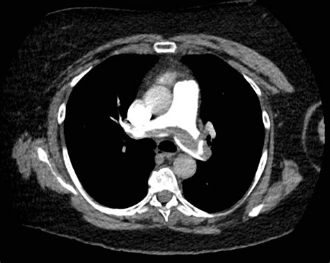 CT Case 009 • LITFL • CT scan interpretation