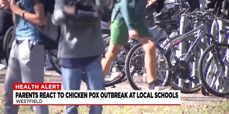 Parents react to chickenpox outbreak across several Westfield schools