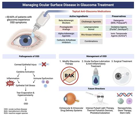 Ocular Surface Disease