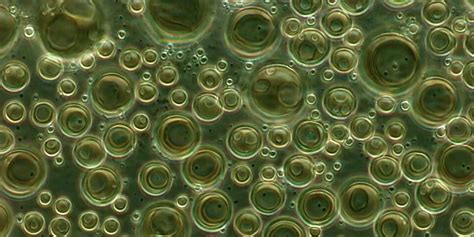 Sun Pharma & Moebius Reveal Promising MM-II Osteoarthritis Data