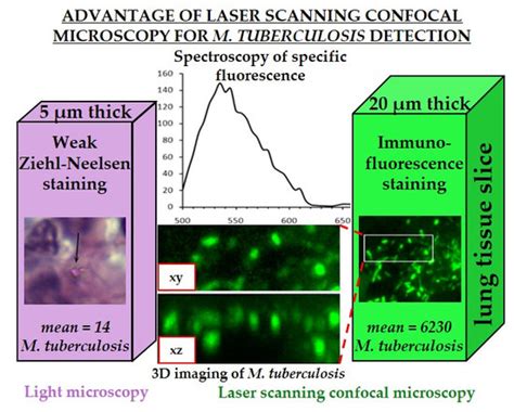 Application of Laser Scanning Confocal Microscopy for the Visualization ...