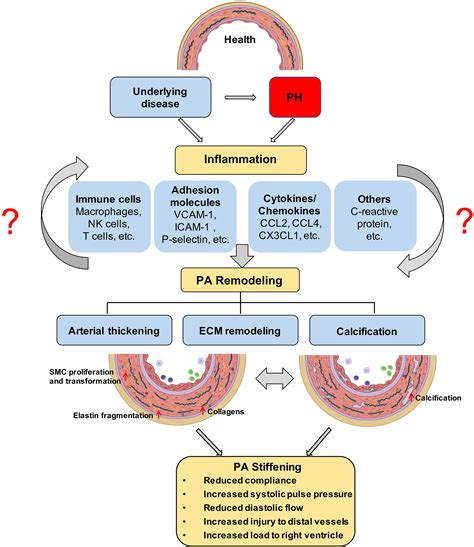 Pulmonary Hypertension