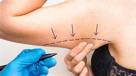 Sono Bello Review 2022 - Rip-Off or Worth To Try? Here is Why..