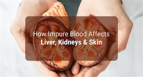 Ayurvedic Herbal Remedies For High BP - Krishna’s Herbal & Ayurveda - Blog