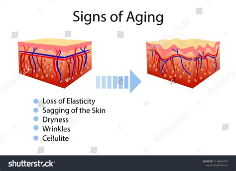 Ageing Signs Texture 的图像结果