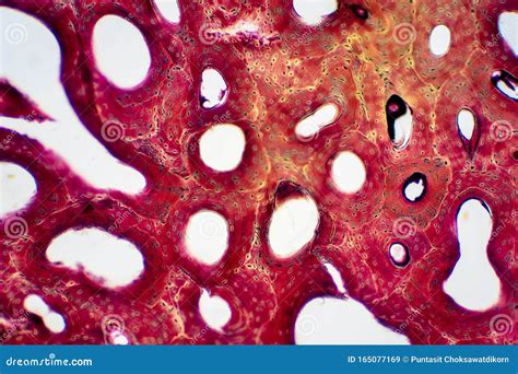 Histology of Human Compact Bone Tissue Under Microscope View for ...