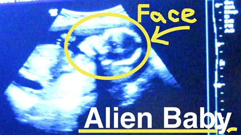 Image result for Alien Ultrasound