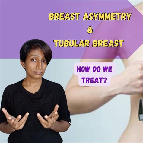 Tubular Breast Augmentation