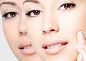 Skin Clinic in Anna Nagar | Weight Loss | Hair Loss Treatment- Glo Clinic