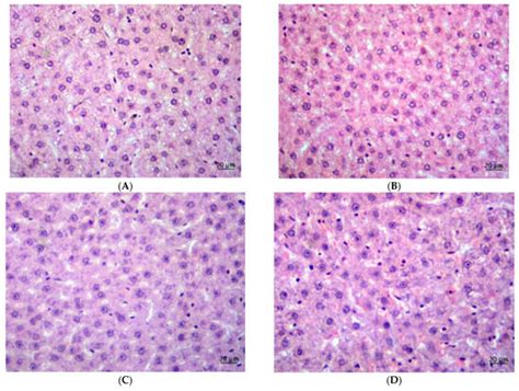 Evaluation of Phaseolus vulgaris Extract in a Rat Model of Cafeteria ...